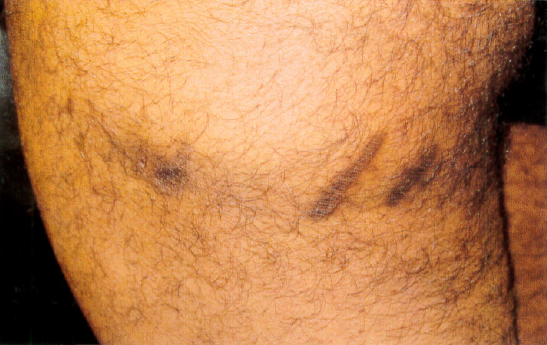 Brian G Injury