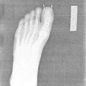 CD accident photos 6