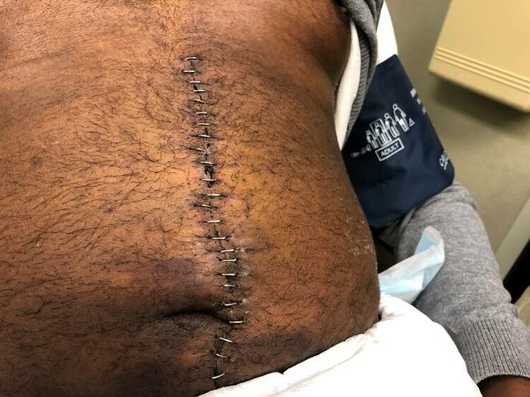 Webster Injury