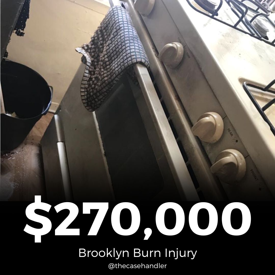 Brooklyn-Burn-Injury-Lawyer-Review-Karla-2